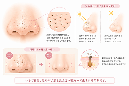 いちご鼻に見えるのはなぜ?