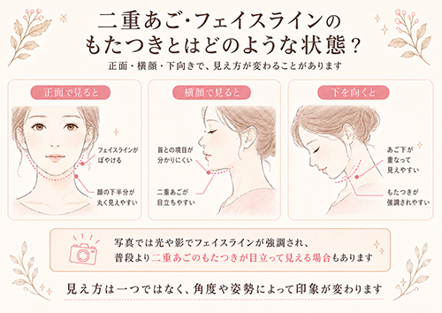 二重あご・フェイスラインのもたつきとはどのような状態?