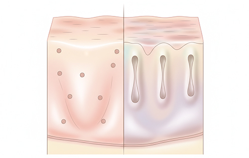 くすみと毛穴が同時に目立つ理由