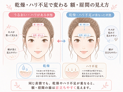 乾燥・ハリ不足が額や眉間のしわに与える影響