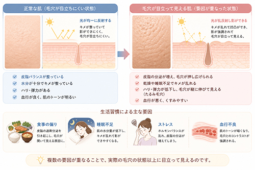 なぜ生活習慣で毛穴が目立つように見えるのか