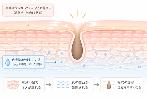 インナードライと毛穴の関係