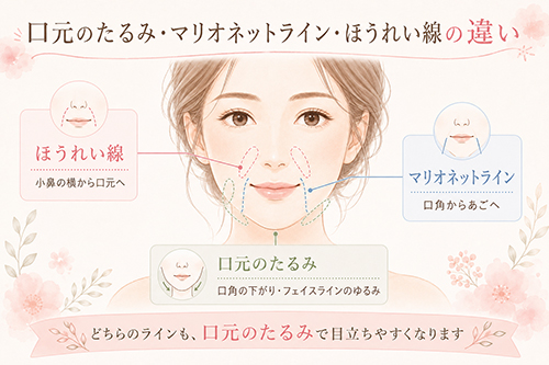 マリオネットラインとほうれい線の違い