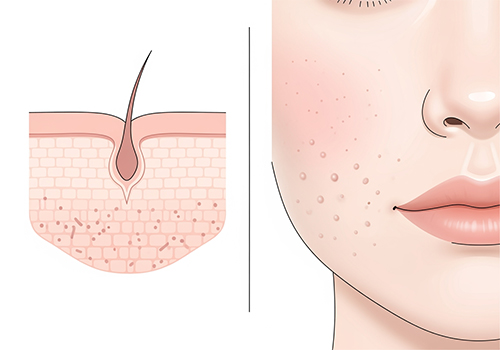 毛穴が目立つと感じる理由とは？開き毛穴の原因と見え方の変化